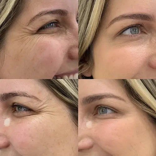 Beauty Boost Med Spa