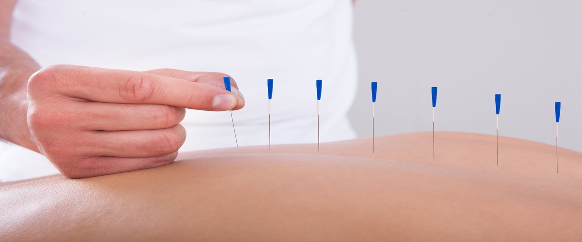 Acupuncture Health Center
