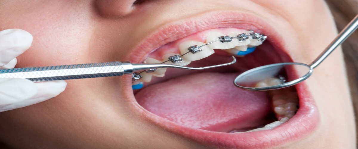 Oceanside Orthodontics